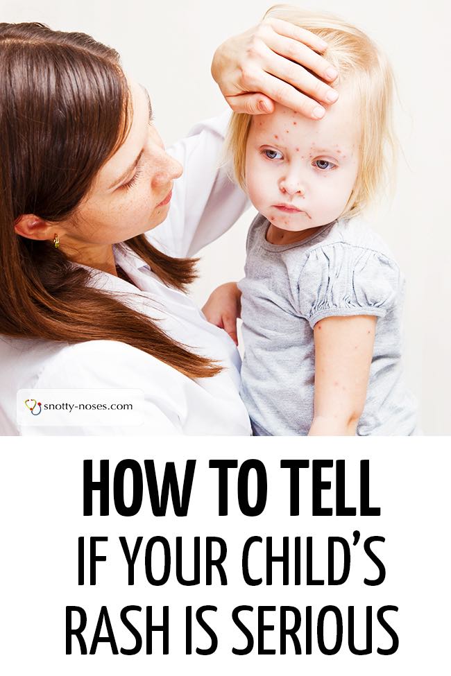 An unwell child with a rash being comforted by their mother. #childhealth #unwellchild #unwellkid #babyrash #childhoodrashes