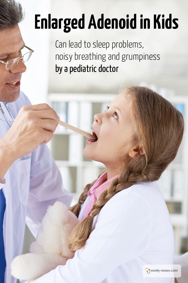 Enlarged Adenoids in Children can lead to noisy breathing, sleep problems and grumpiness. Written by a paediatric doctor.